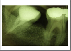 Digital Teeth Xray Dental Clinic