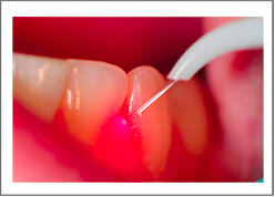 Oral Surgery Dental Clinic in Vadodara