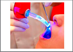 Laser Dentistry and Teeth Whitening Clinic